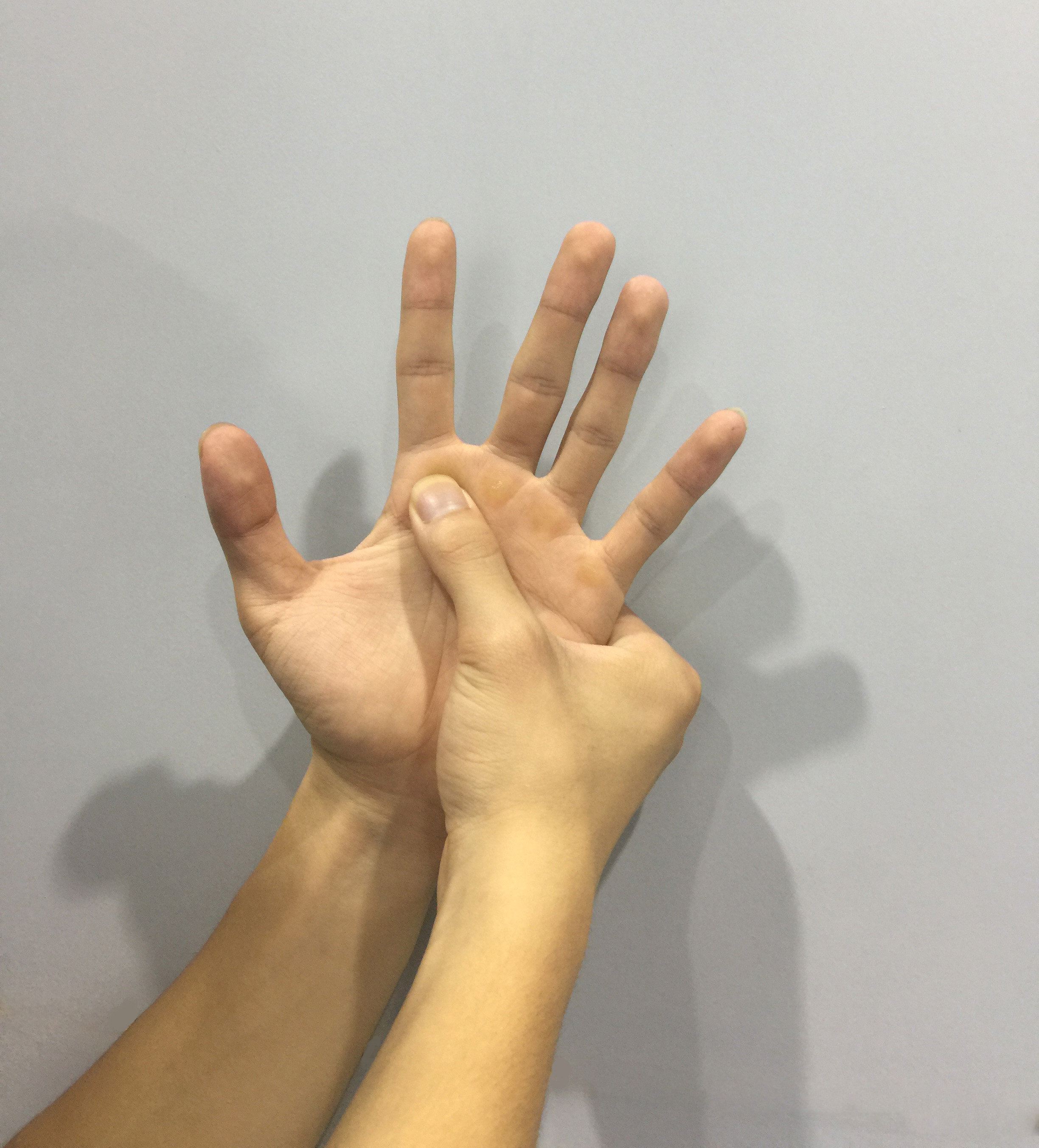Wrist Fracture Treatment - Manchester Hand & Wrist Surgery